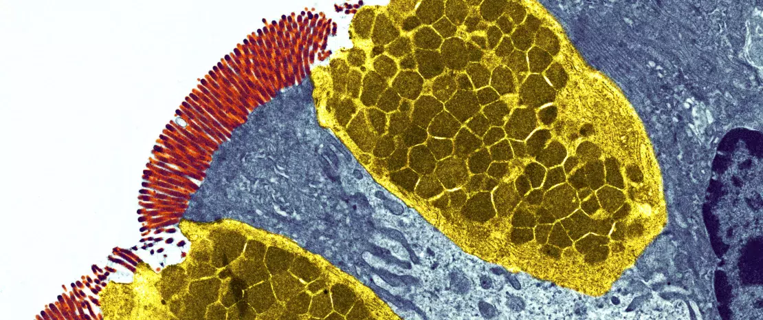 Goblet cells. Coloured transmission electron micrograph (TEM) of a section through goblet cells in the lining of the small intestine,part of the digestive tract.