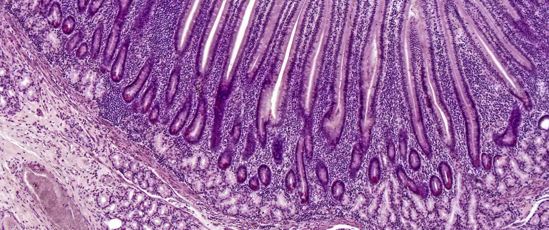 Micrographie lumineuse d’un duodénum humain. HE stain, Magnification: 40X