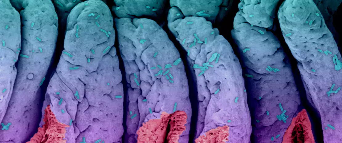 De la dysbiose intestinale à l’infection urinaire