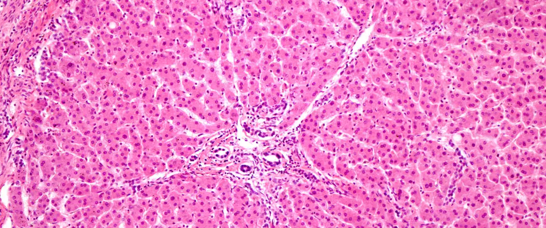 Binge drinking : une dysbiose intestinale liée à l’alcool favoriserait l’addiction