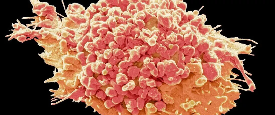 Photo: Immunotherapies: a Phase II study confirms the benefit of combined FMT