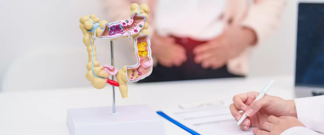 Colorectal cancer: could bacteria within tumors predict  disease progression?