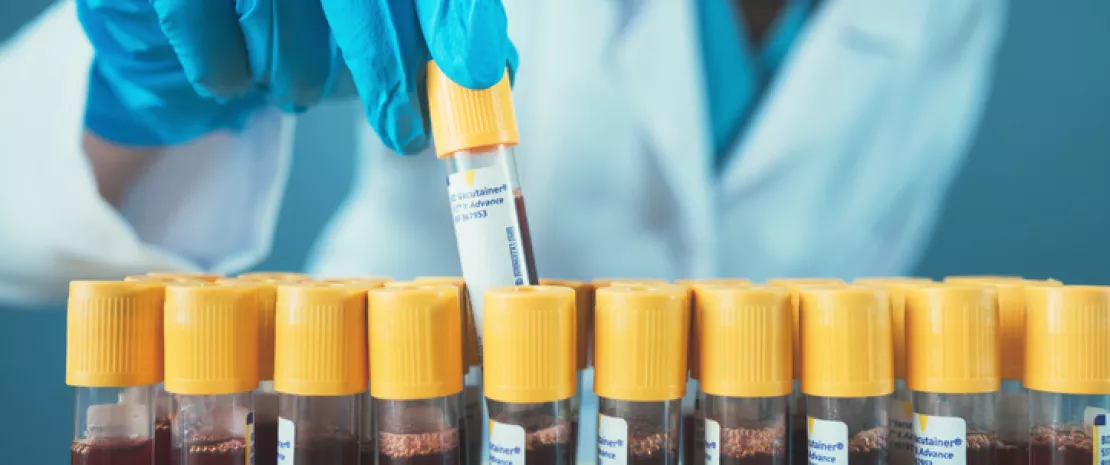 Photo : Could blood be used as an indicator of gut microbiota diversity?