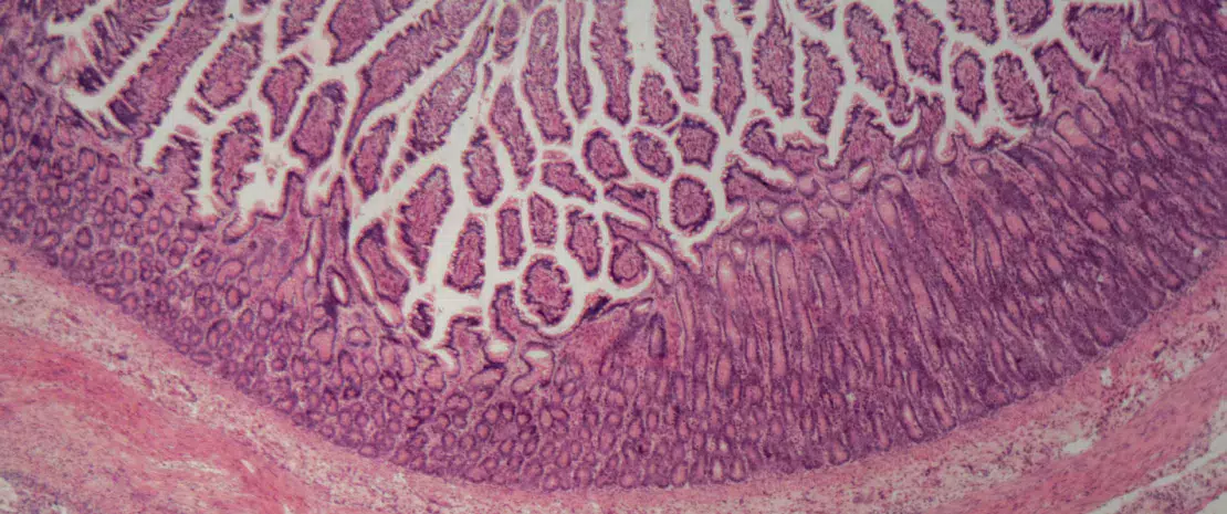 Rôle de l’épithélium intestinal image