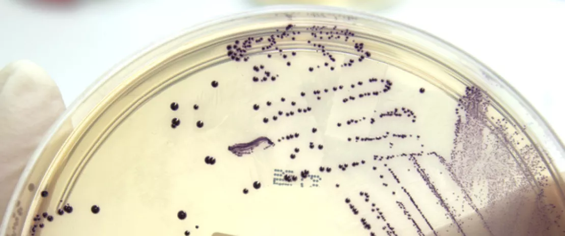 Photo : Lantibiotics: a new avenue in the fight against resistant bacteria