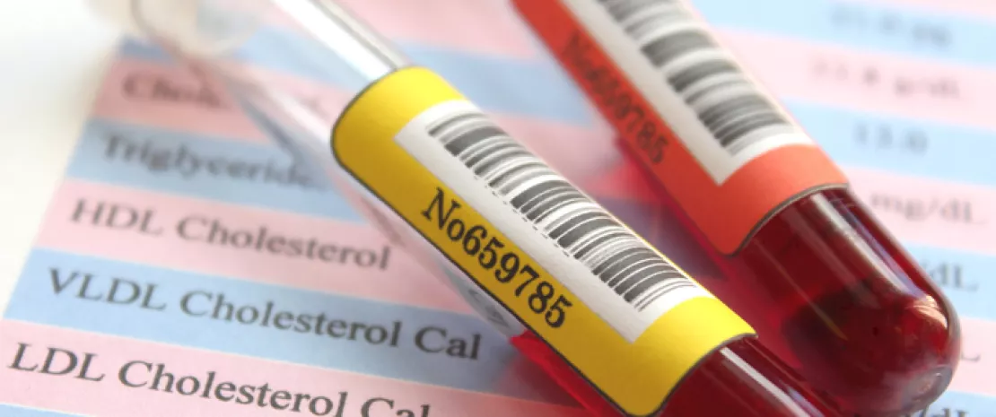 Photo : Is there a relationship between gut microbiota and circulating metabolites?