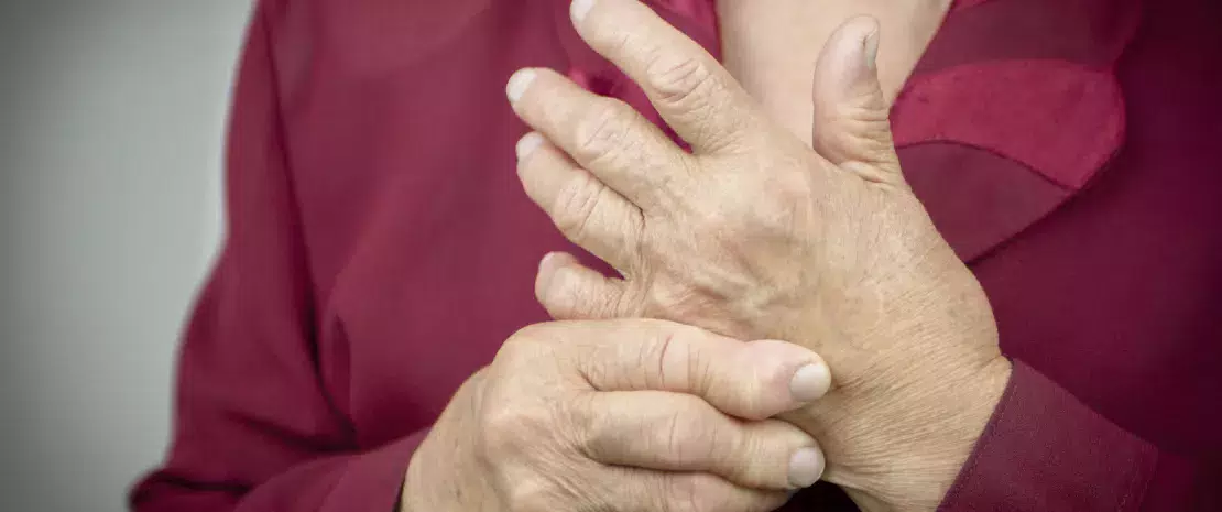 Actu PRO : Polyarthrite : le microbiote intestinal altéré dès les stades précoces