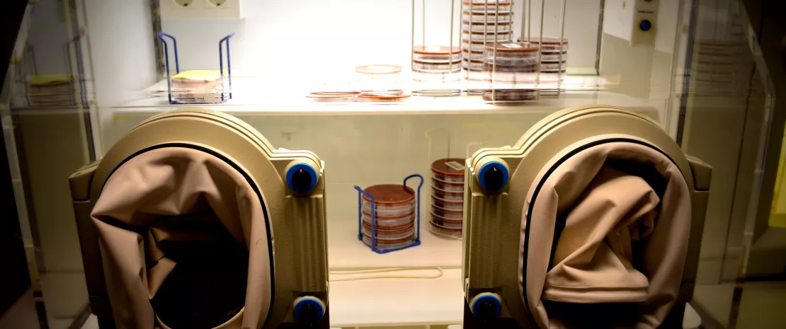 Photo : Ulcerative colitis: an innovative fecal transplant protocol