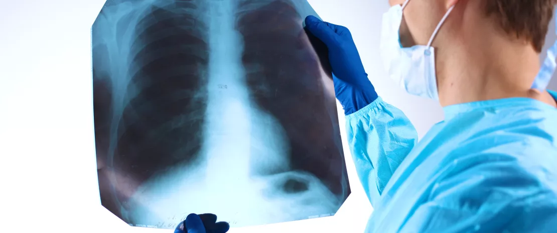 Actu PRO un lien etabli entre microbiote intestinal et infections respiratoires