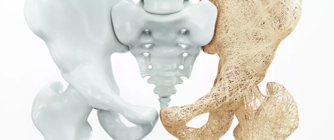 Actu GP : Analyser le microbiote intestinal pour déterminer le risque d’ostéoporose ?