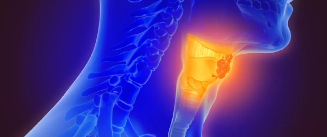 Photo : Length of hospital stay and certain medication linked to oropharyngeal disturbance