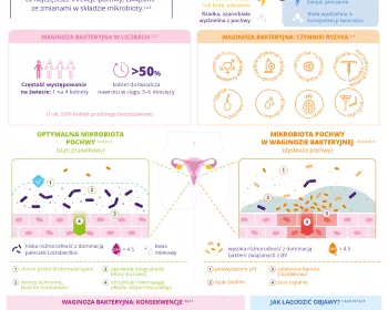 Infografika – Czym jest bakteryjne zapalenie pochwy - PL
