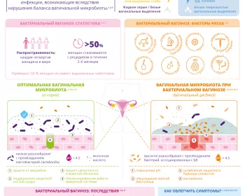 Инфографика - Что такое бактериальный вагиноз - RU