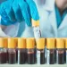 Actu PRO : Le sang, indicateur de la diversité du microbiote intestinal ?