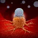Actu PRO: Immunothérapie et cancer : pas d’antibiothérapie préalable