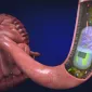 Actu GP : Une gélule high-tech pour prélever le microbiote intestinal