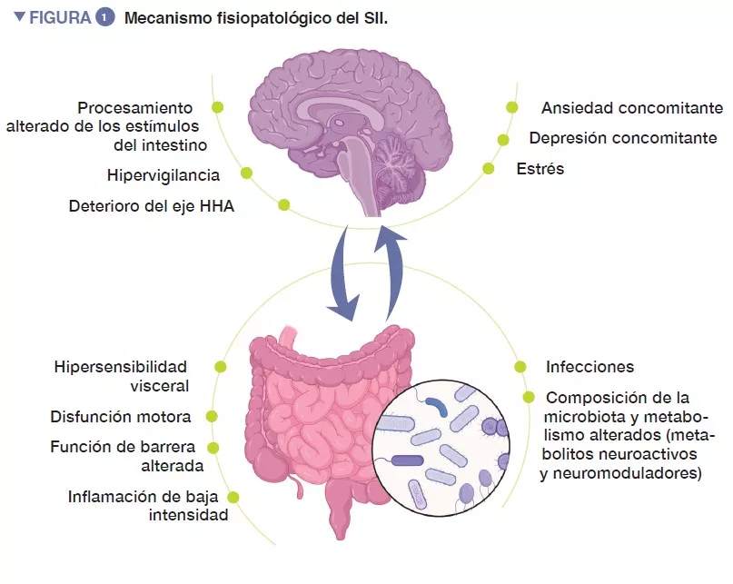 NL13_Synthèse figure 1 ES