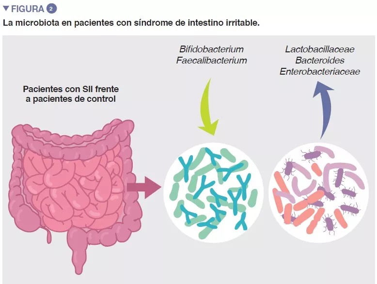 NL13_Synthèse figure 2 ES