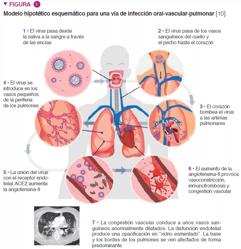 Microbiota 16 Covid fig1 ES