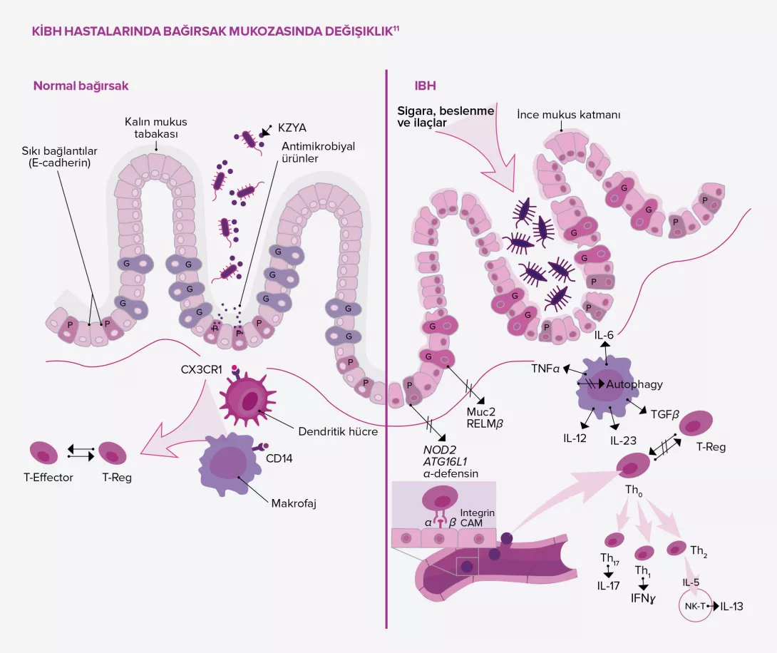 BiocodexMICI_TUR0303-article2