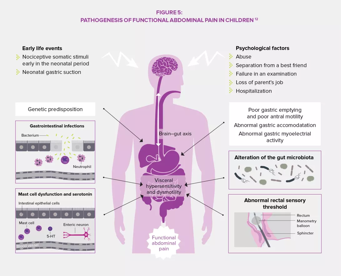 FGIDS-In-children-infography1