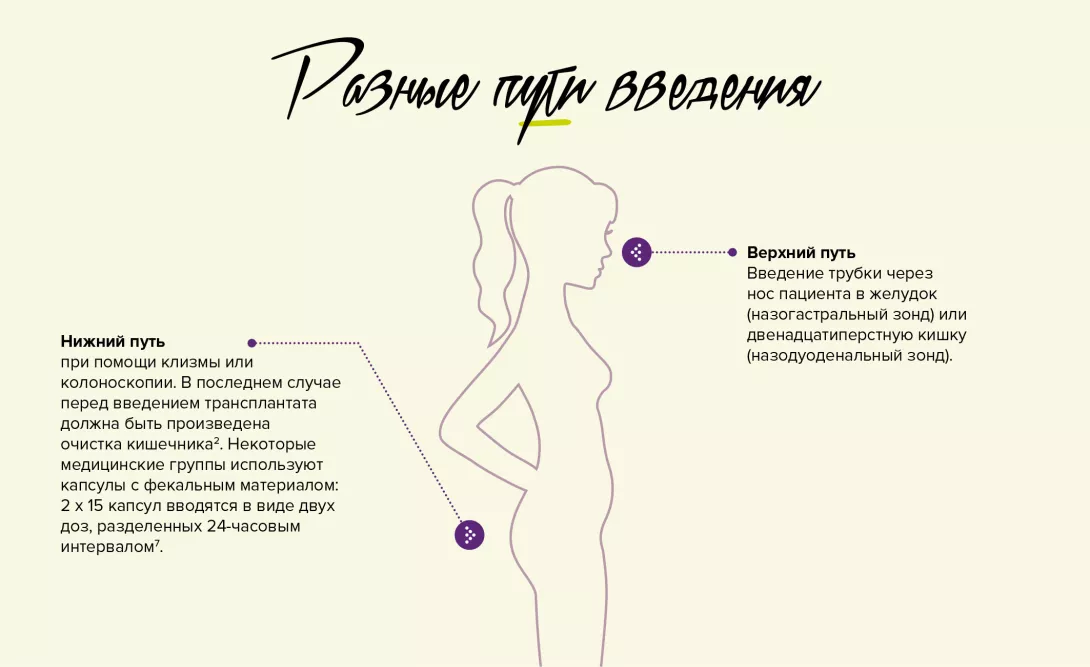 FMT-in-practice-infography-2_RU