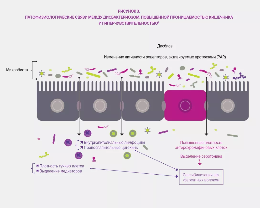 Functional-gastrointestinal-RU-infography3