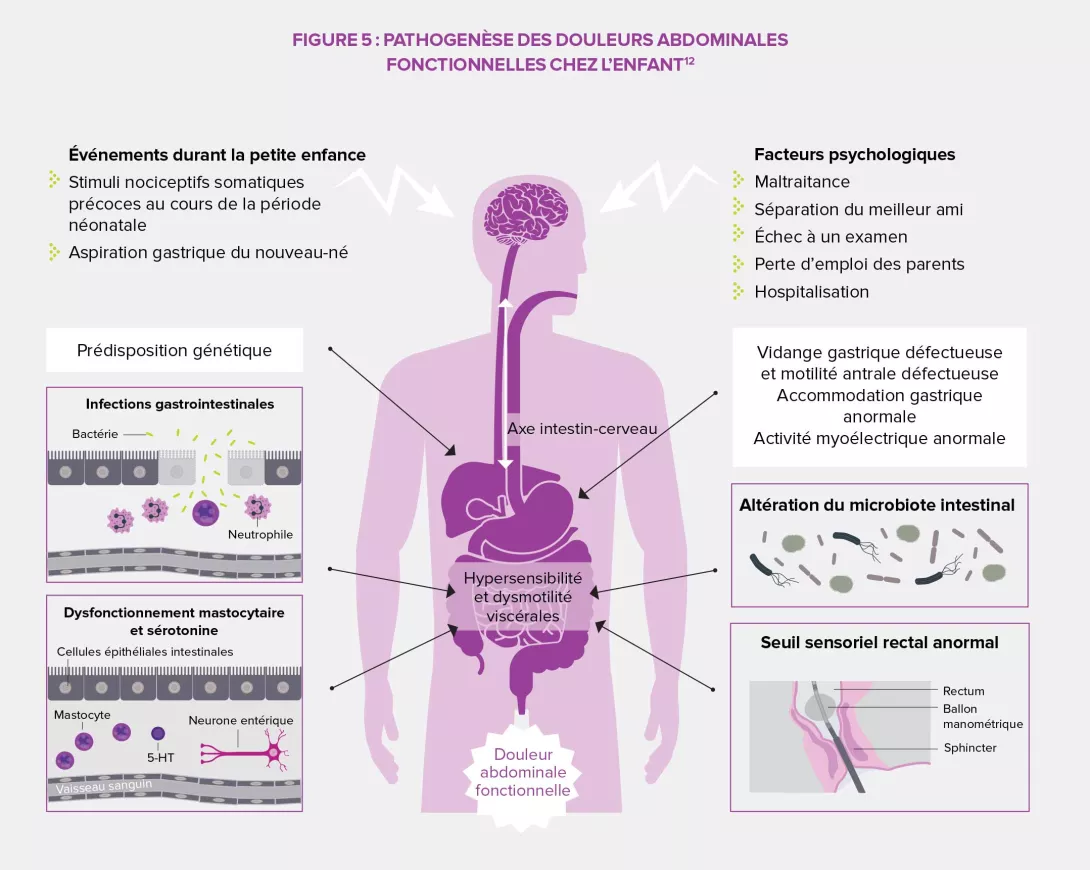 TFI-Axe-Chez-enfant-infographie1