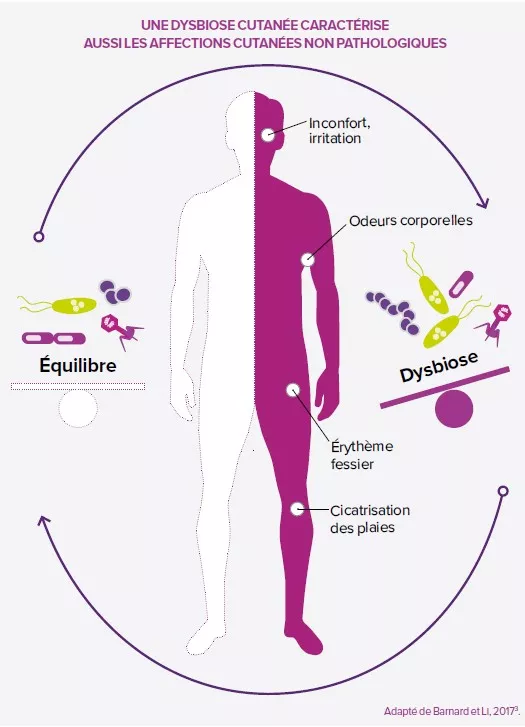 Dysbiose cutanée